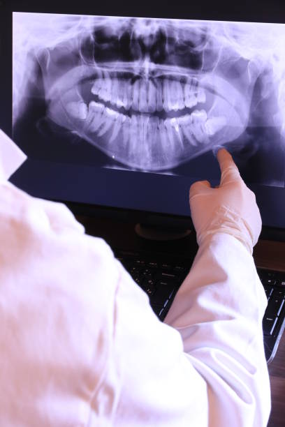 Best Emergency Treatment for Toothache in Spanish Fort, AL