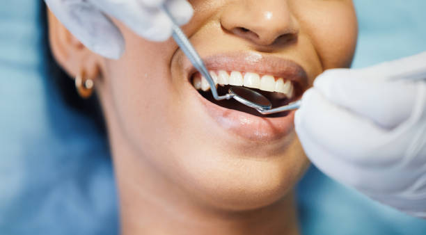 Best Pediatric Emergency Dentist in Spanish Fort, AL